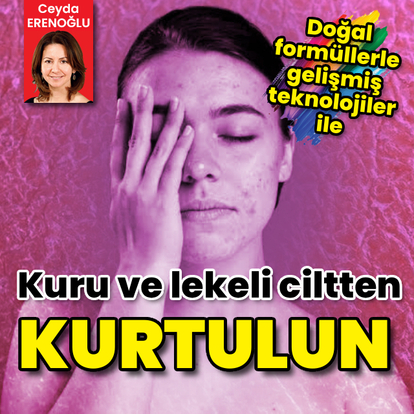Doğal formüller ve gelişmiş teknolojiler yardımıyla kuru ve lekeli cildinizden kurtulun