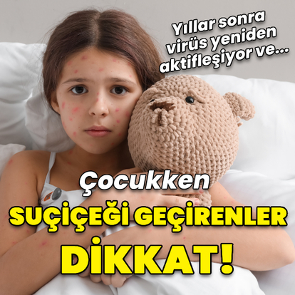 Küçükken suçiçeği geçirenler her an zona ile karşılaşabilir