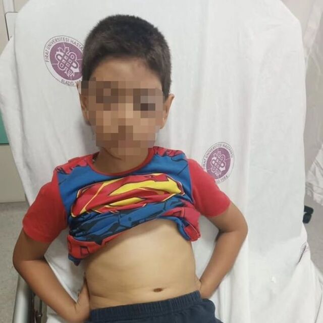 Oğluyla itişen çocuğa fiziksel müdahale eden polis, görevden uzaklaştırıldı