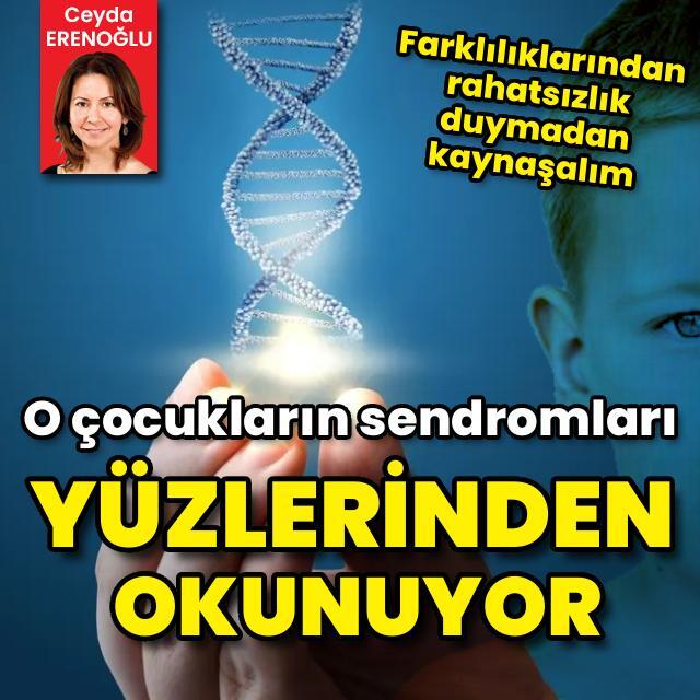 O çocukların hastalıkları yüzlerinden okunuyor