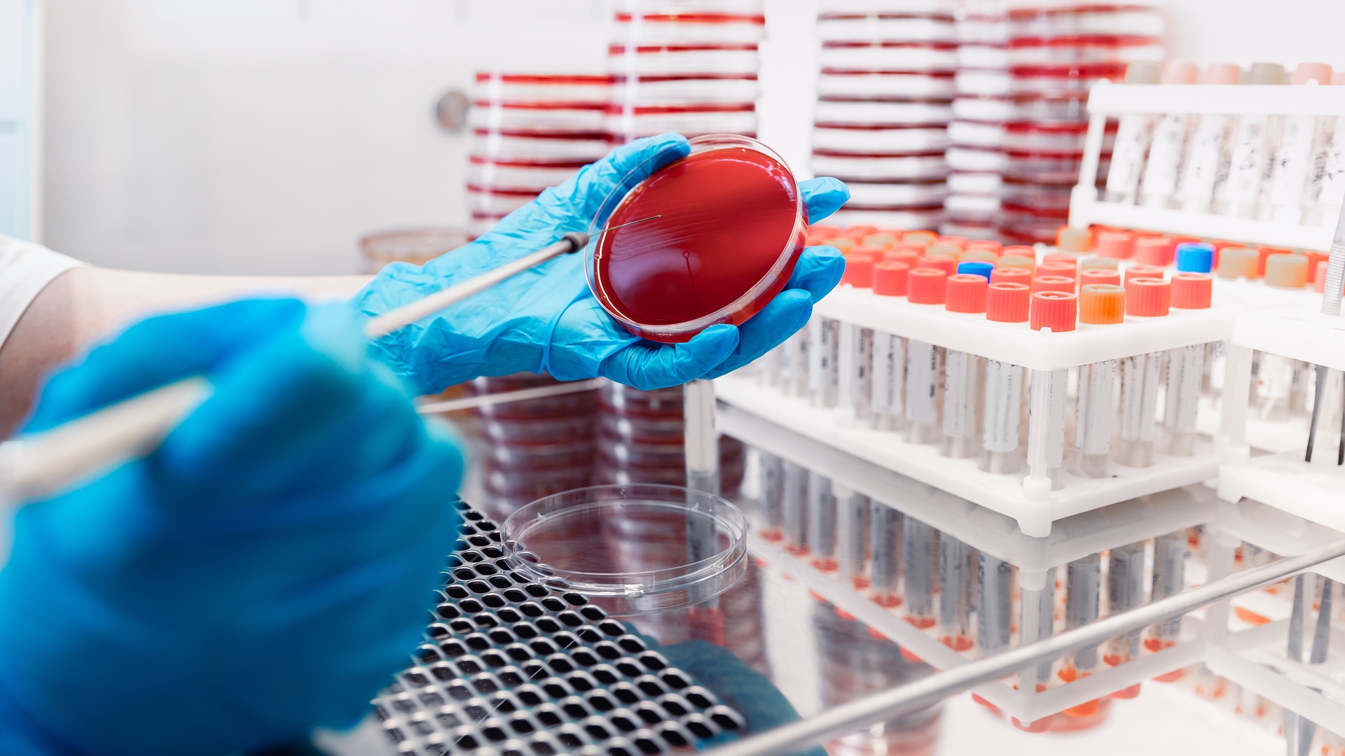 Yoğun bakımlarda direnç alarmı | Sağlık Haberleri