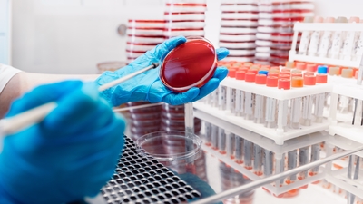 Yoğun bakımlarda direnç alarmı