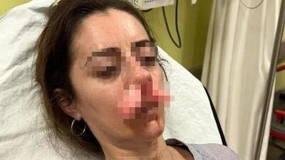 Otomobilin kapısı silah sayıldı!