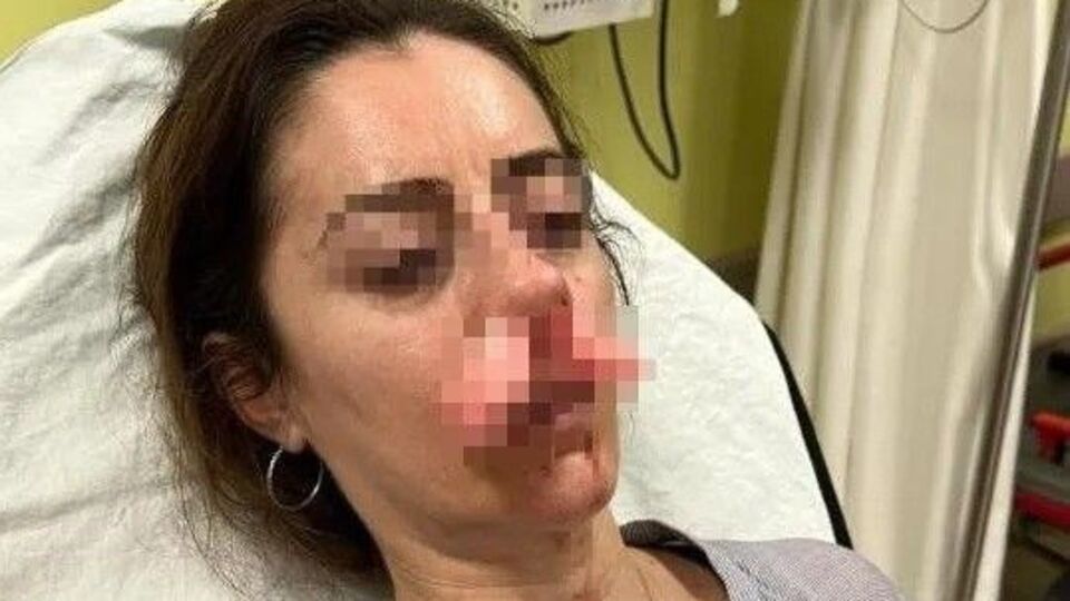 Otomobilin kapısı silah sayıldı!