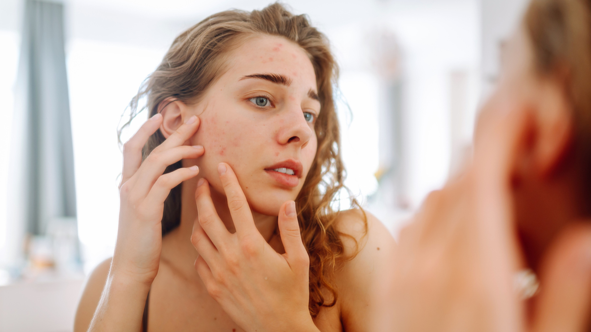Sivilce de değil siyah nokta da... Cilt problemlerinin başında gelen "komedonlar" için nasıl bir rutin izlenmeli?