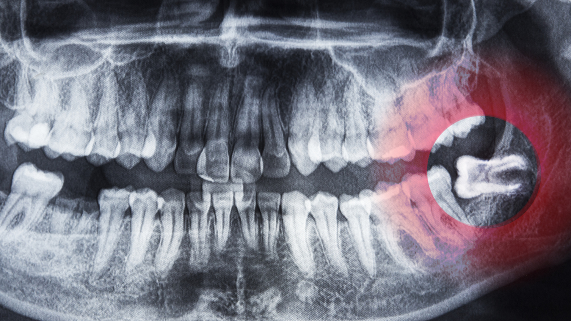 20'lik dişler, bebeklerin kavrama refleksi: İnsan vücudunun artık işe yaramayan 7 özelliği!