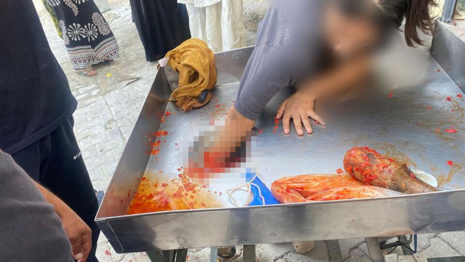 Salça makinesine elini kaptırmıştı!