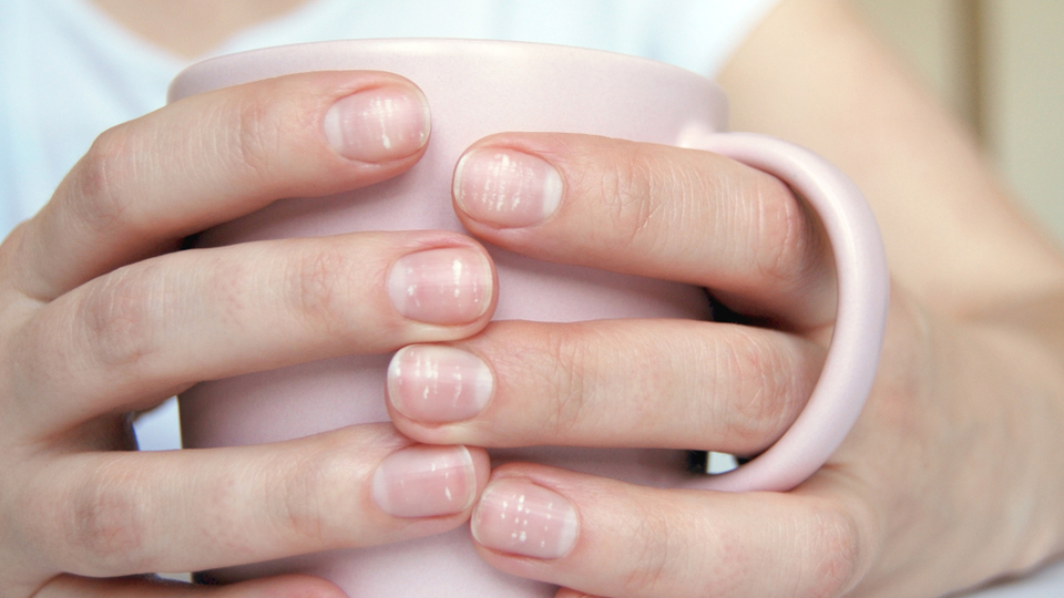 Zararsız bir iz mi, hastalık habercisi mi?