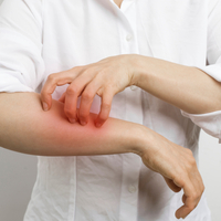 Mevsim değişimi demek egzama demek!