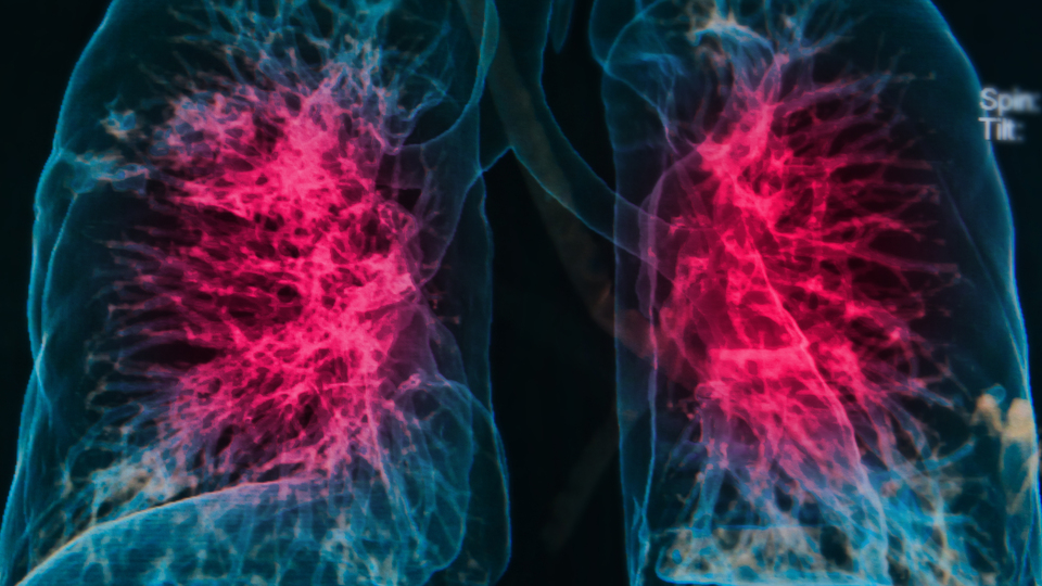 Çocukları da yaşlıları da tehdit ediyor! Aşıyla korunmak mümkün