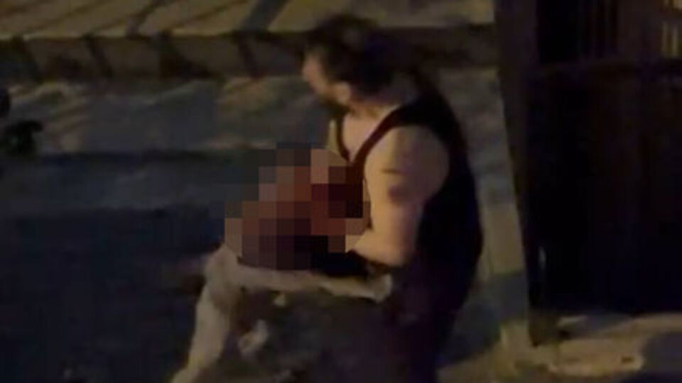 Pitbull cinsi köpek sahibine saldırdı