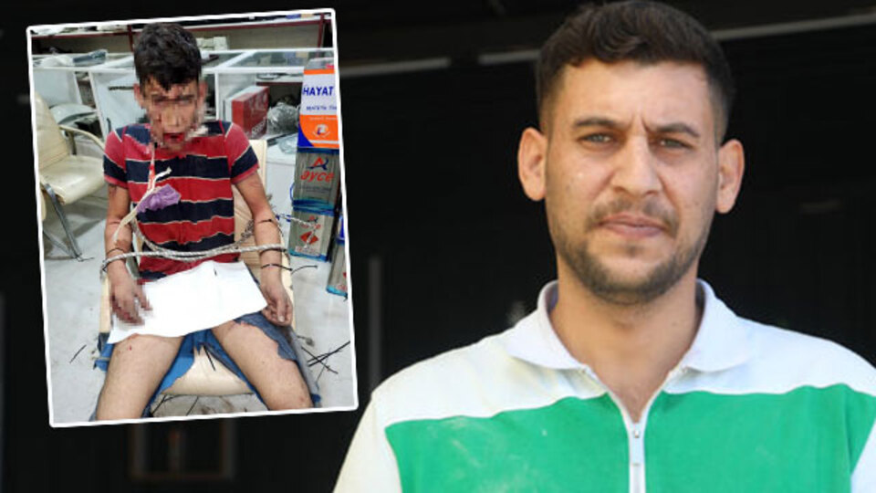 Böcek yedirip, dişlerini kırdılar! İşte vahşete istenen ceza!