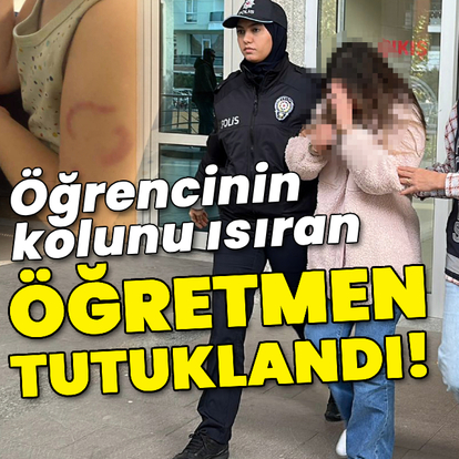 Öğrencinin kolunu ısıran öğretmen tutuklandı!