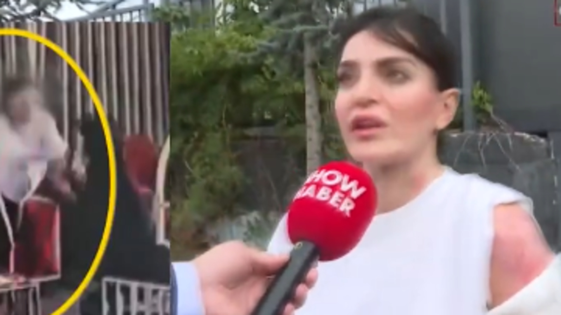 Kaynar Kahveyle Yakan Kişiye Şok İtiraf: 'Beni Kıskanmış Olmalı'