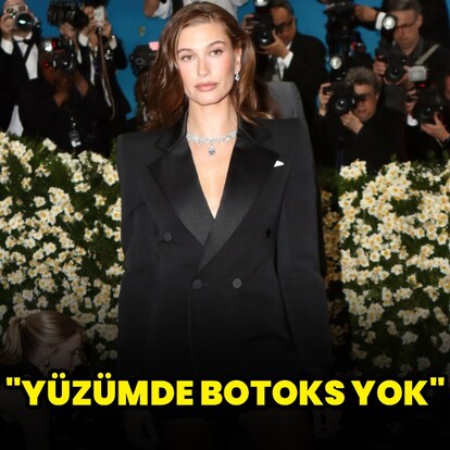 "Yüzümde botoks yok"