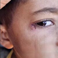 Öğrencinin yüzünde sigara söndürdü!