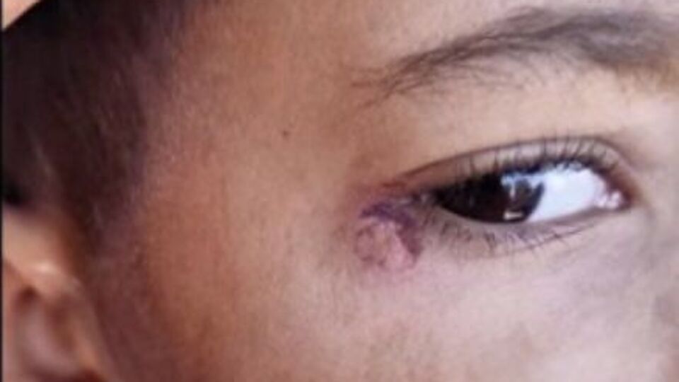 Öğrencinin yüzünde sigara söndürdü!