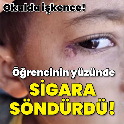 Öğrencinin yüzünde sigara söndürdü!