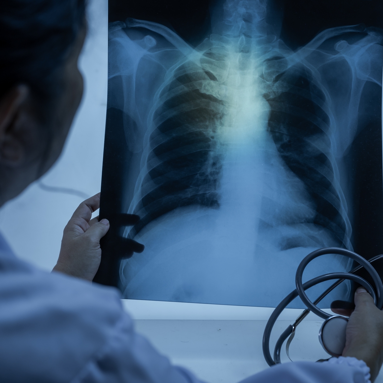 50 yaş üstü sigara içicilerine 'tomografi' uyarısı!