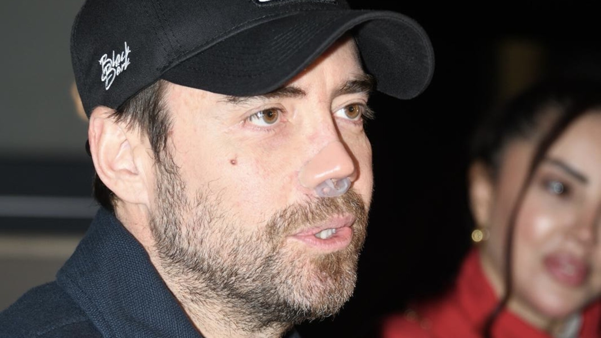 Murat Dalkılıç'tan burun ameliyat açıklaması - Magazin haberleri