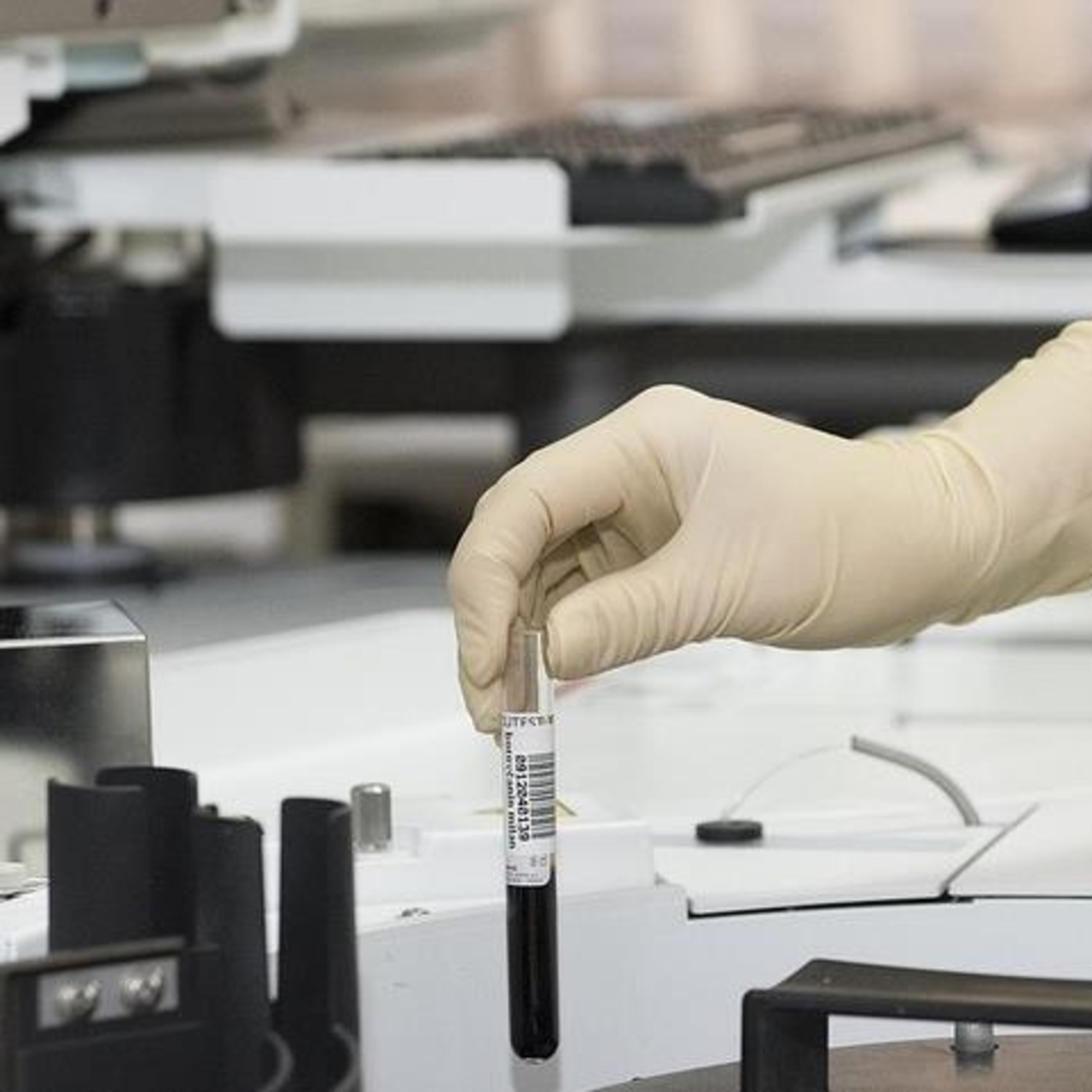 15 aylık bebeğin yemek borusundan pil ve Lego çıkarıldı