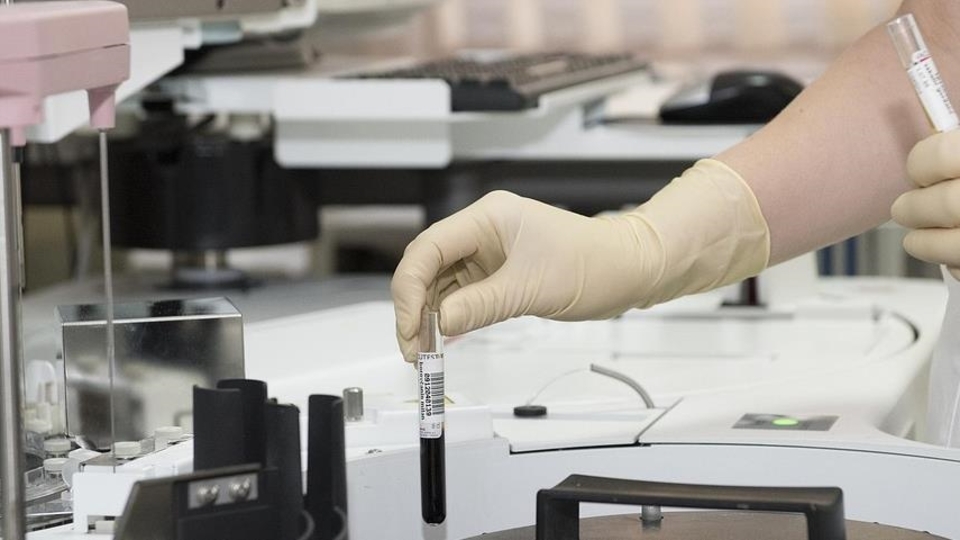 15 aylık bebeğin yemek borusundan pil ve Lego çıkarıldı