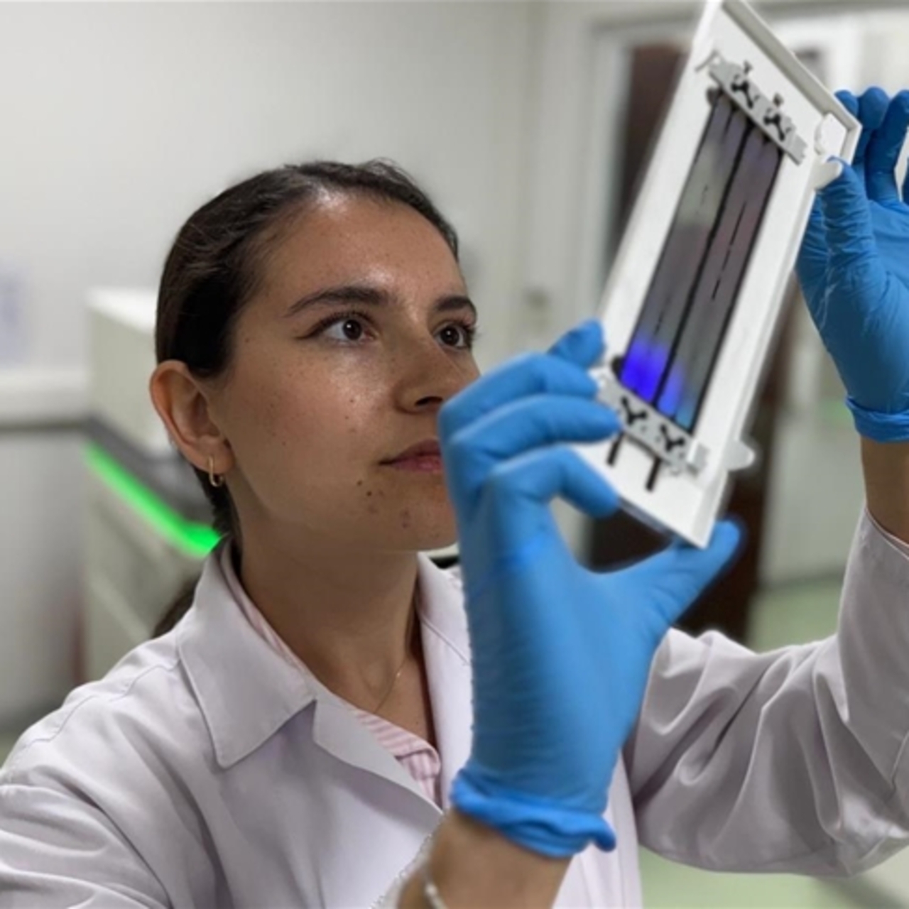 Akciğer kanserinde radyoterapiye yanıtı belirleyen 12 gen tespit edildi