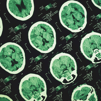 Günde en az 3 bin adım atmak Alzheimer'ın ilerlemesini yavaşlatabilir