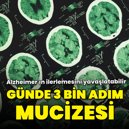 Günde en az 3 bin adım atmak Alzheimer'ın ilerlemesini yavaşlatabilir