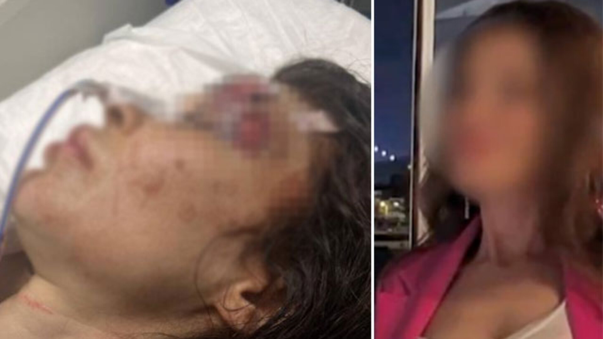 Sibel'i yumrukla darp eden boksör bıçaklamıştı... Kan donduran detaylar ortaya çıktı | SON DAKİKA HABER | Son dakika haberleri