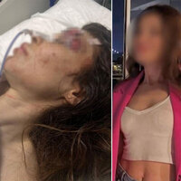 Sibel'i yumrukla darp eden boksör bıçaklamıştı... Detaylar ortaya çıktı!