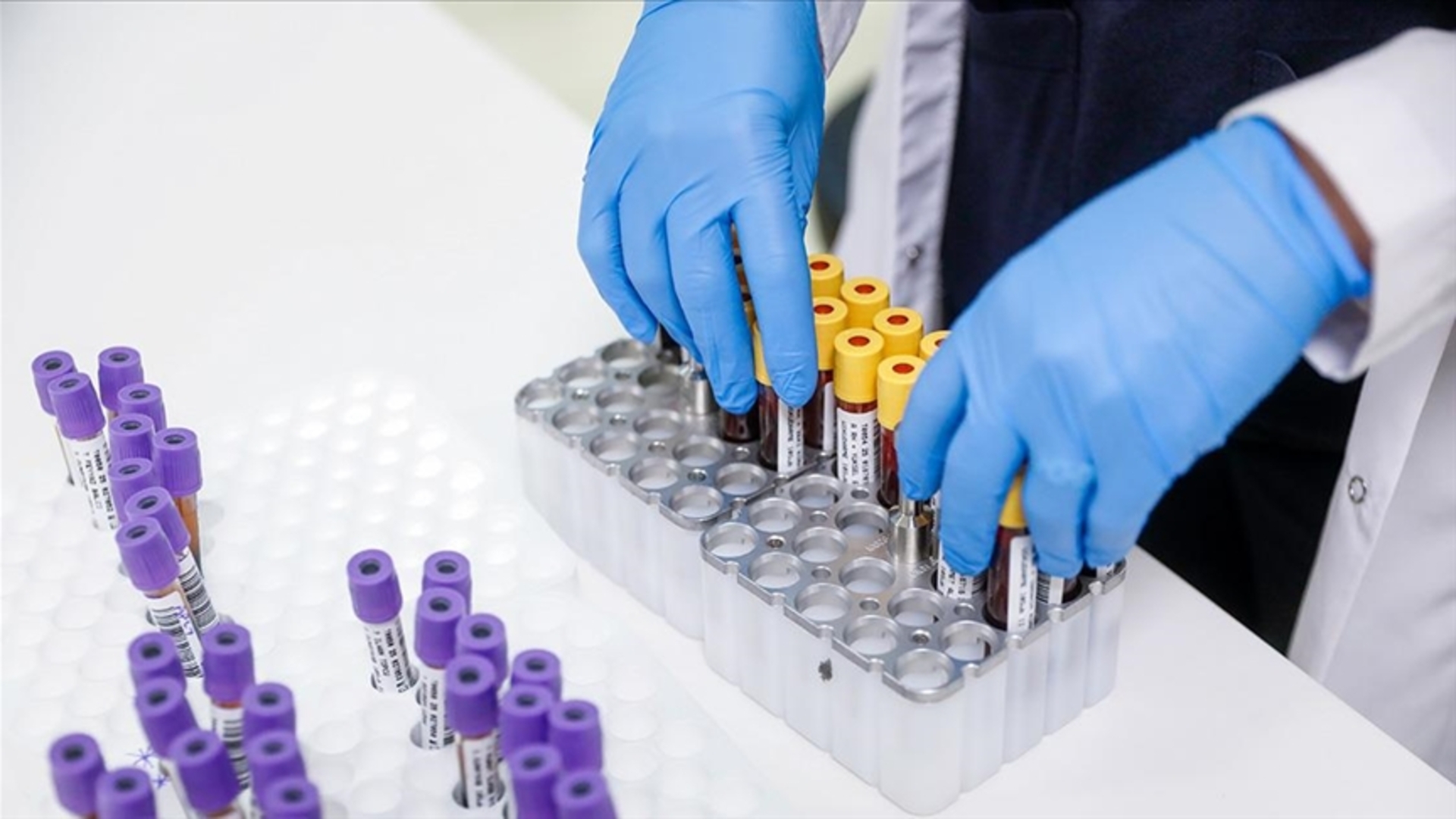 "Lösemi artık korkutucu değil" | Sağlık Haberleri