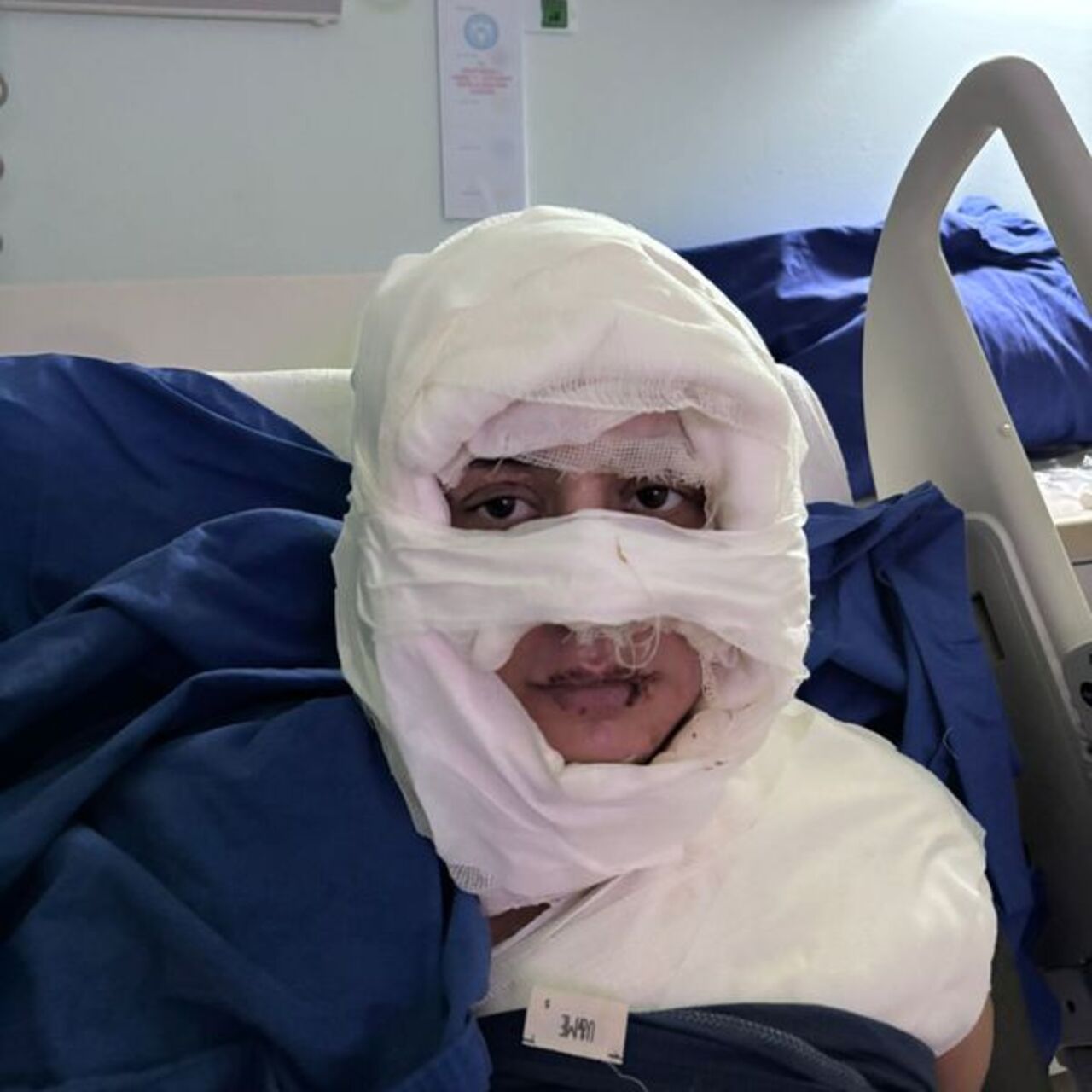 Genç kadını kolonyayla yaktı | Flaş Gelişme