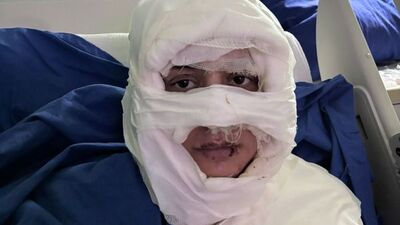 Genç kadını kolonyayla yaktı