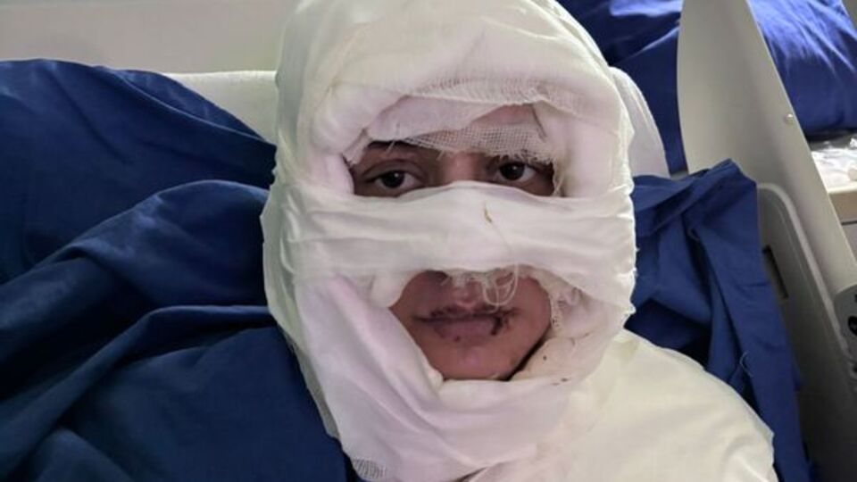 Genç kadını kolonyayla yaktı