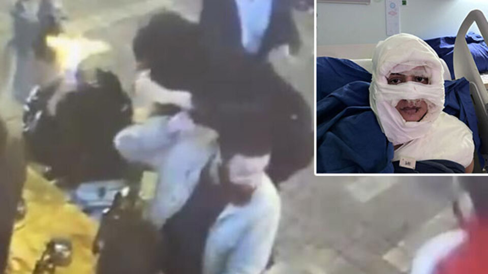 Eğlence mekanında yakılan Gözde konuştu: Kendisini tanımıyorum