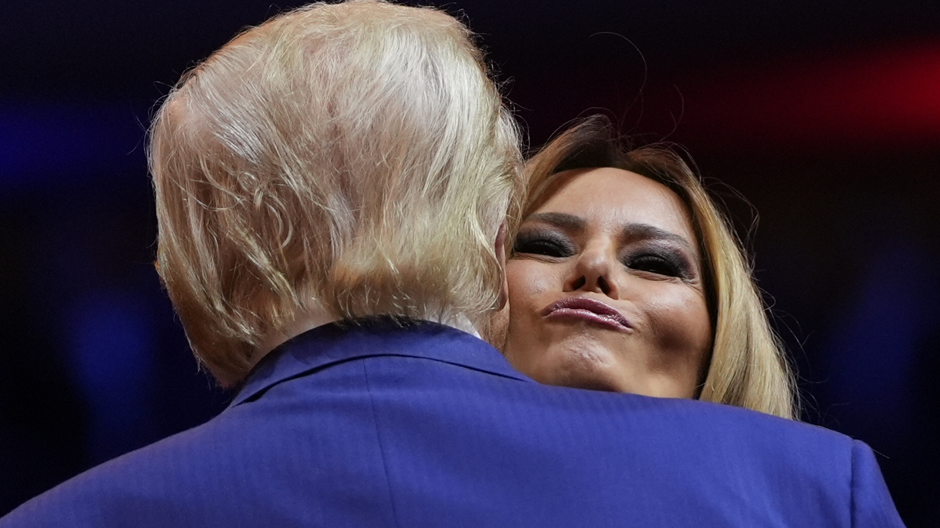 'Mar-a-Lago yüzü' trendi yükselişte: Herkes Trump'ın yakınları gibi olmak istiyor