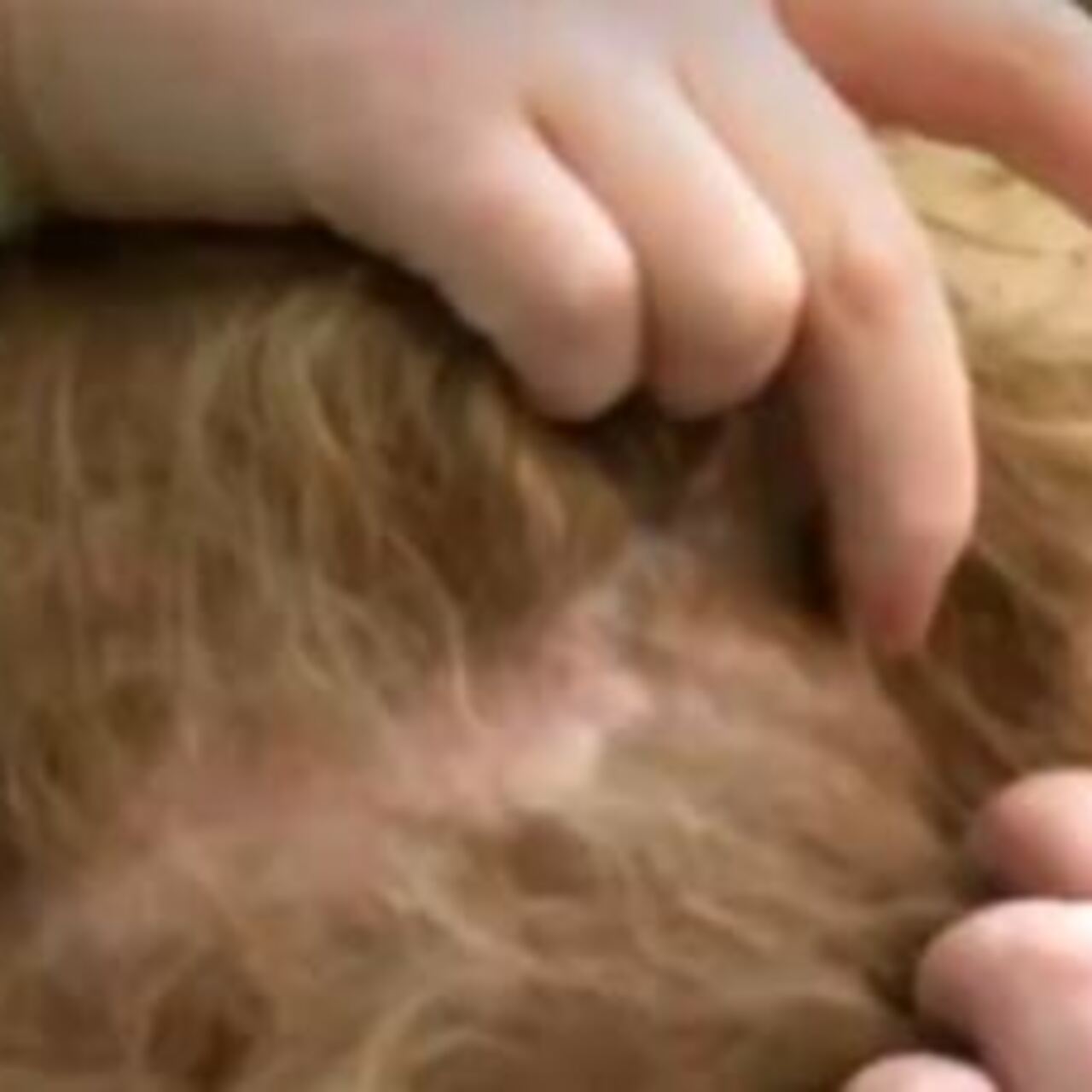 Kafasında iğne unutuldu!