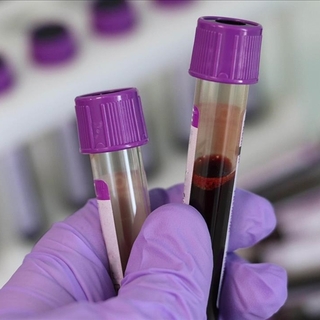 Kan kanseri tedavisinde yeni dönem