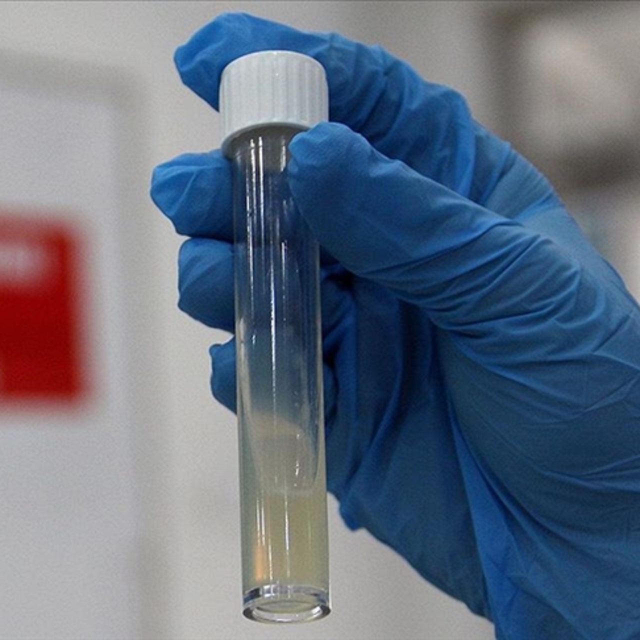 Her yıl 1 milyon kişi tüberküloz nedeniyle ölüyor