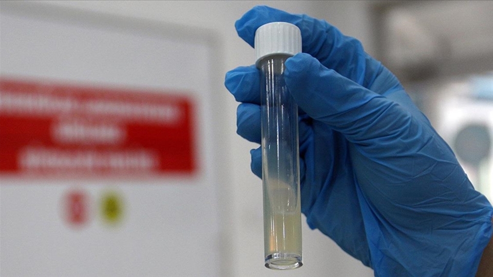 Her yıl 1 milyon kişi tüberküloz nedeniyle ölüyor