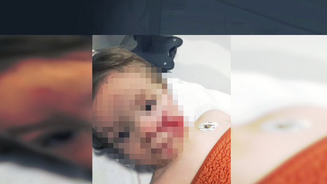 İki kardeş pitbull saldırısına uğradı