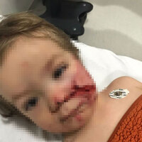 Ankara Valiliği'nden 2 kardeşe saldıran pitbull ve sahibiyle ilgili açıklama!