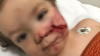 Ankara Valiliği'nden 2 kardeşe saldıran pitbull ve sahibiyle ilgili açıklama!