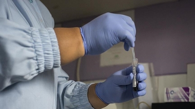 DSÖ: 2024'te 1.3 milyon kişi AIDS'e yakalandı