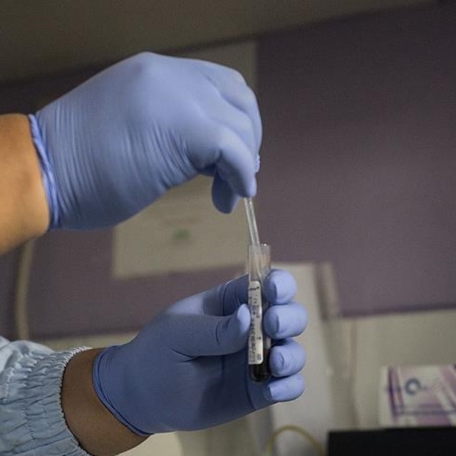 DSÖ: 2024'te 1.3 milyon kişi AIDS'e yakalandı