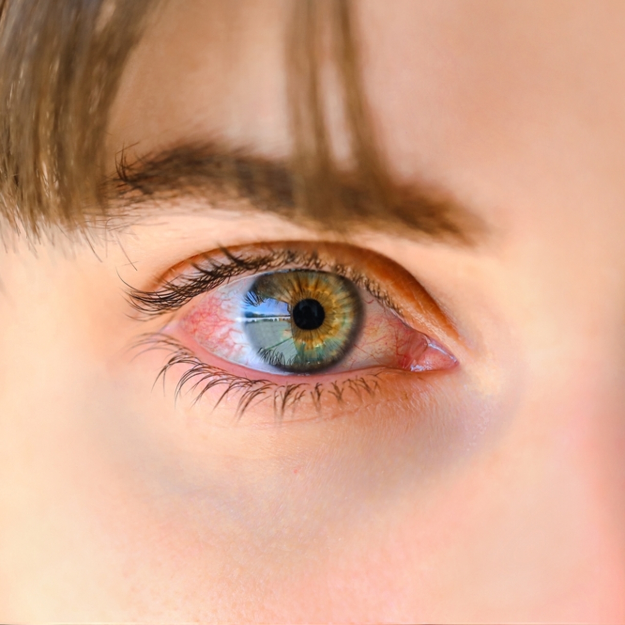 Göz tansiyonunda erken teşhis körlüğü engelliyor