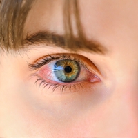 Göz tansiyonunda erken teşhis körlüğü engelliyor