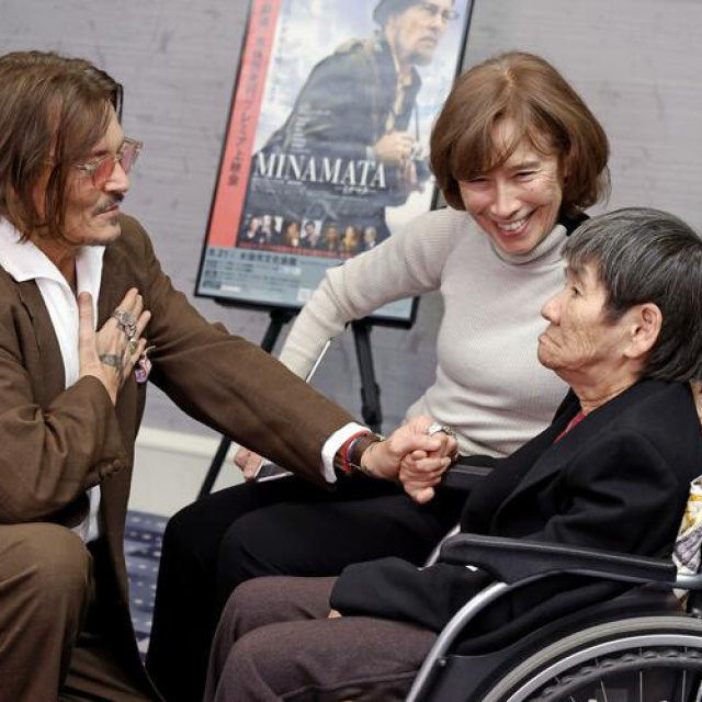 'Minamata' hastasıyla buluştu