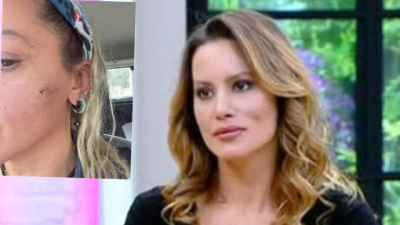 "Kocam tarafından darp edildim"